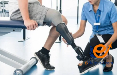 سعر الطرف الصناعي للقدم في مصر
